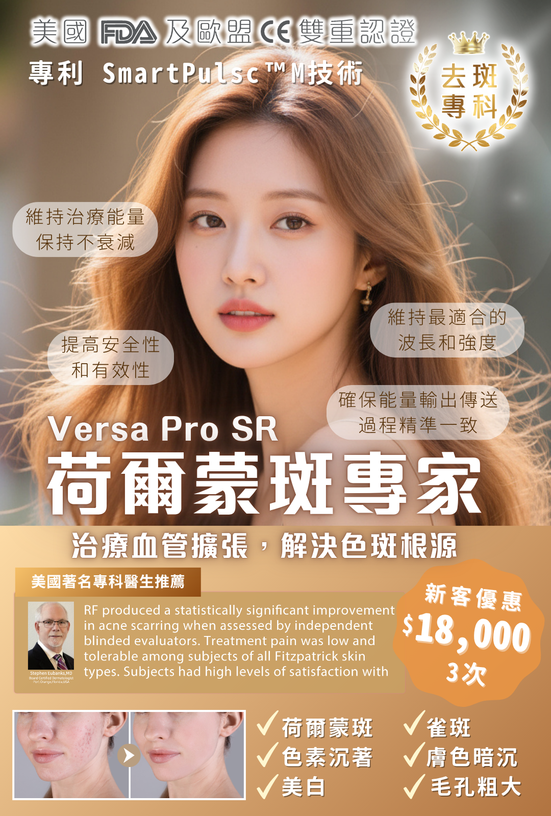 Versa Pro SR 荷爾蒙斑專家