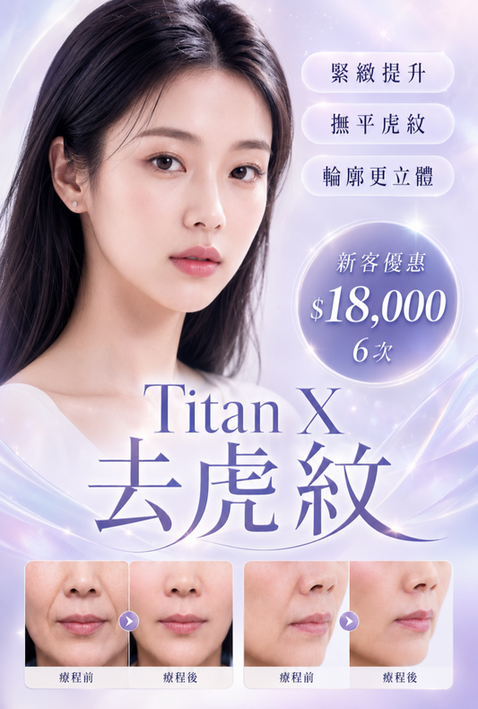 Titan X 去虎紋