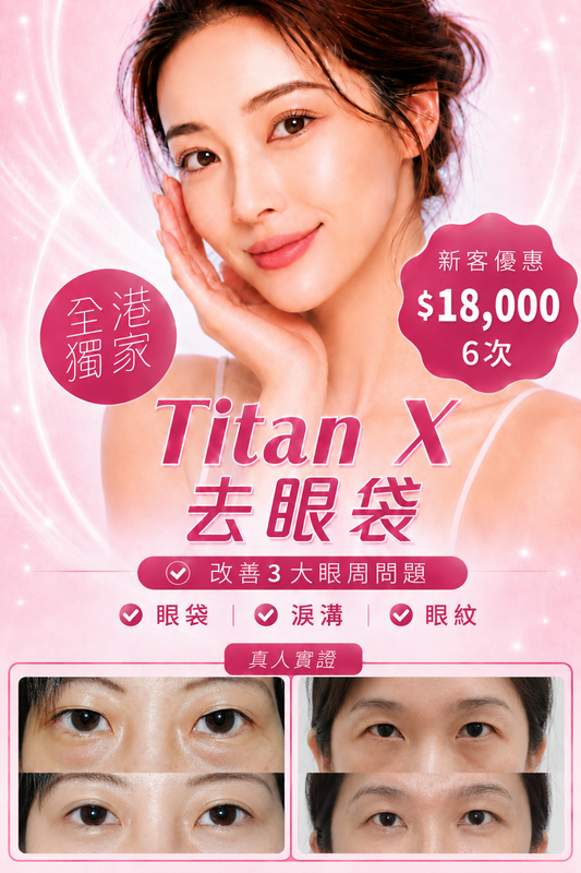 Titan X 去眼袋