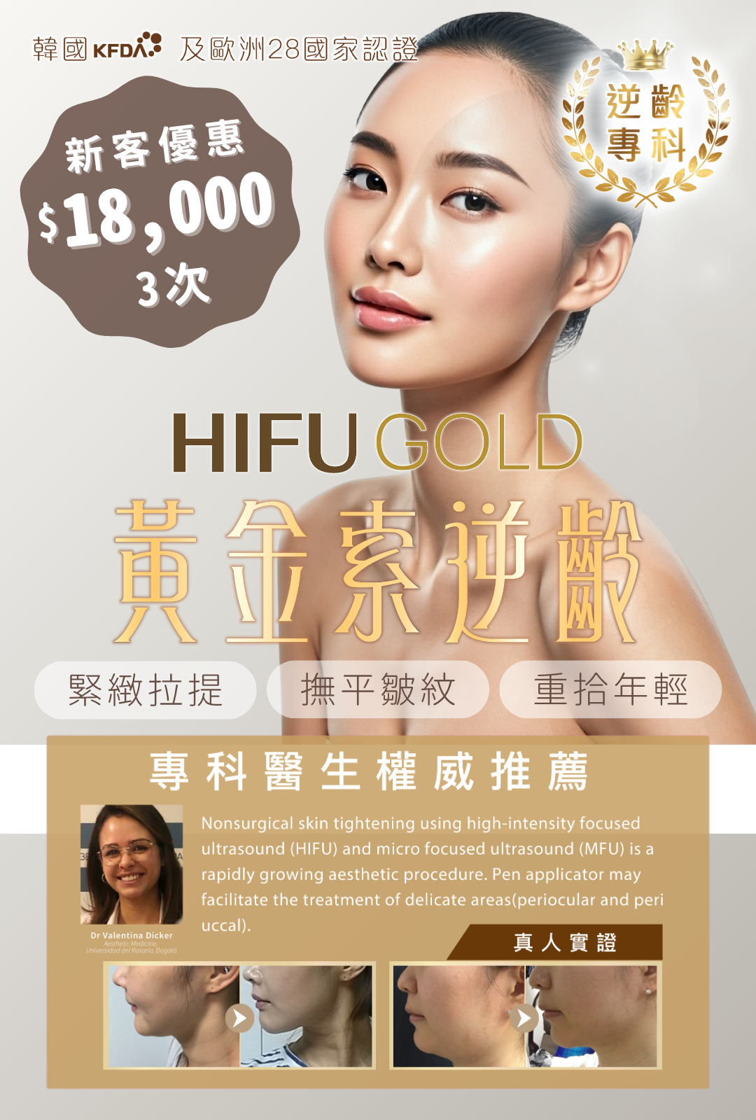 HIFU Gold 黃金索逆齡