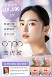 Onda 去虎紋