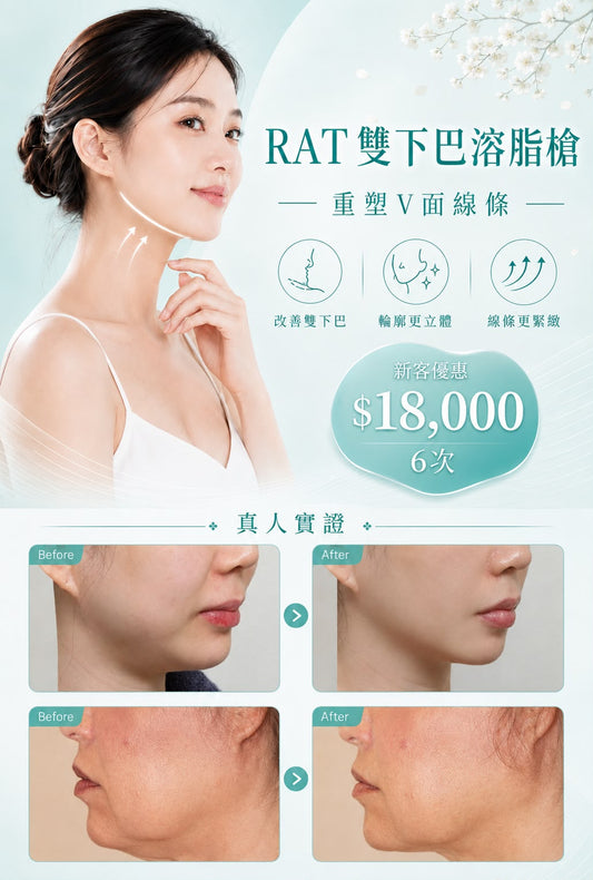 RAT雙下巴溶脂槍
